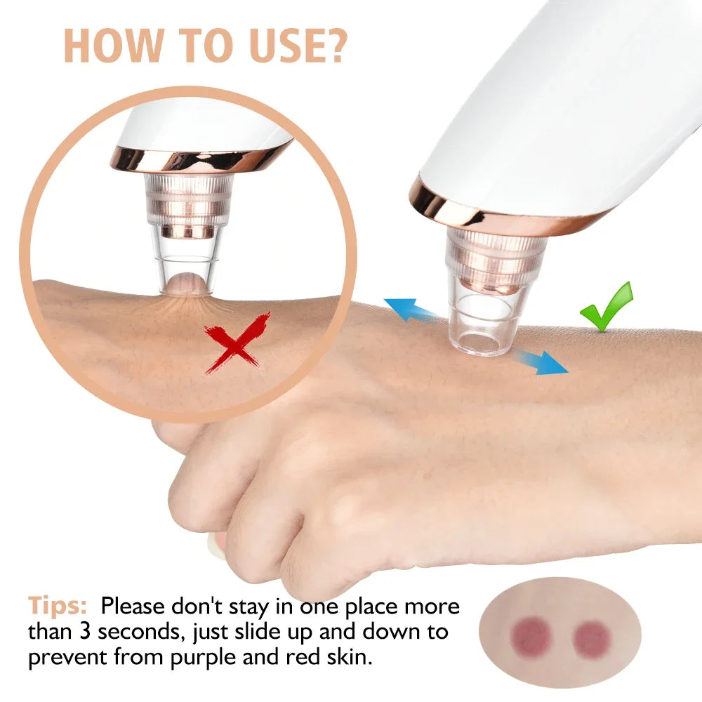 New Electric Blackhead Remover Vacuum Acne Cleaner Black Spot Removal Facial Deep Cleansing Pore Cleaner Machine for Skin Care