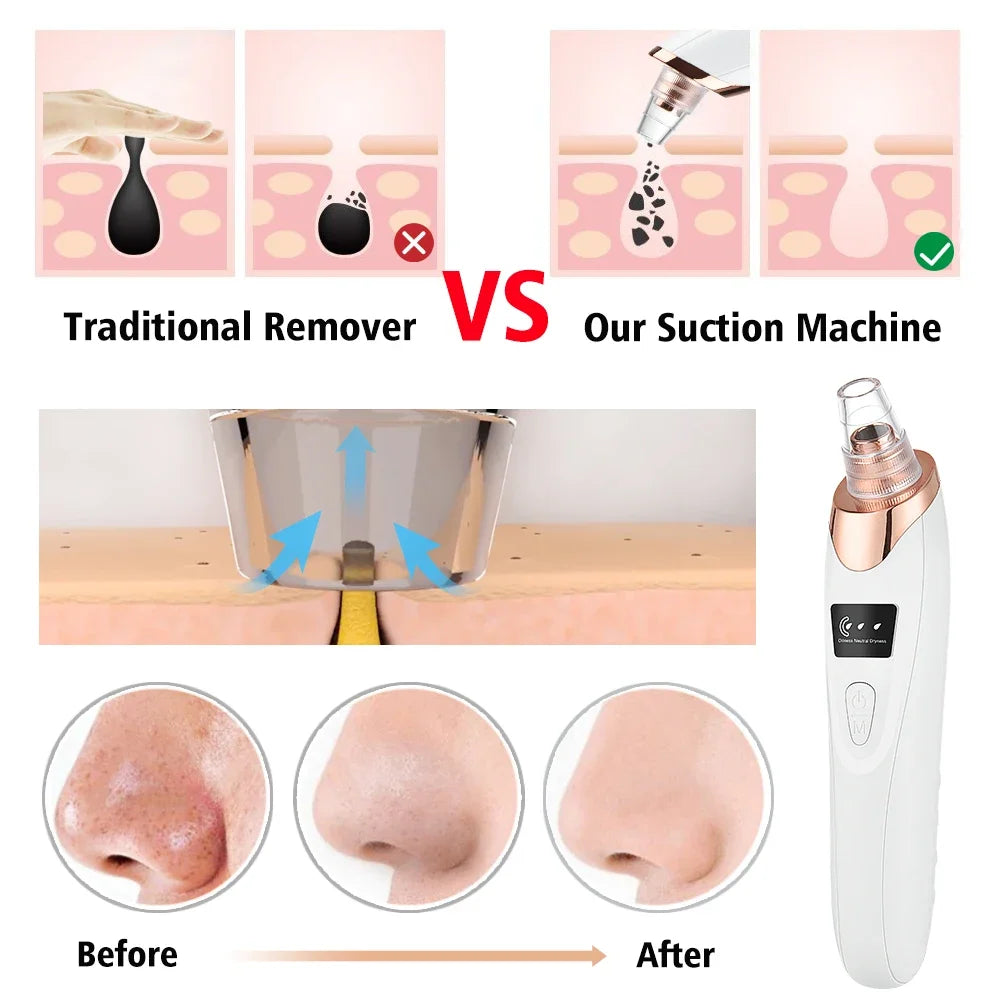 New Electric Blackhead Remover Vacuum Acne Cleaner Black Spot Removal Facial Deep Cleansing Pore Cleaner Machine for Skin Care