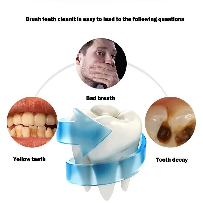 New Automatic Sonic Electric Toothbrush Silicone U-Shaped Tooth Brush USB Charge Waterproof Toothbrush 4 Modes Timer Blue Light